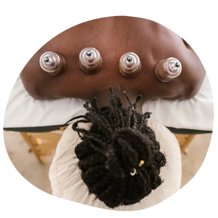 Cupping